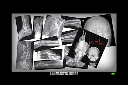 Bone Boards