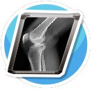 X-Ray