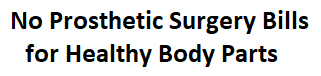 No Prosthetics Over Healthy
