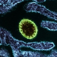 Langya henipavirus (LayV)