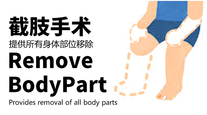 [MilKyC]截肢手术RemoveBodyPart