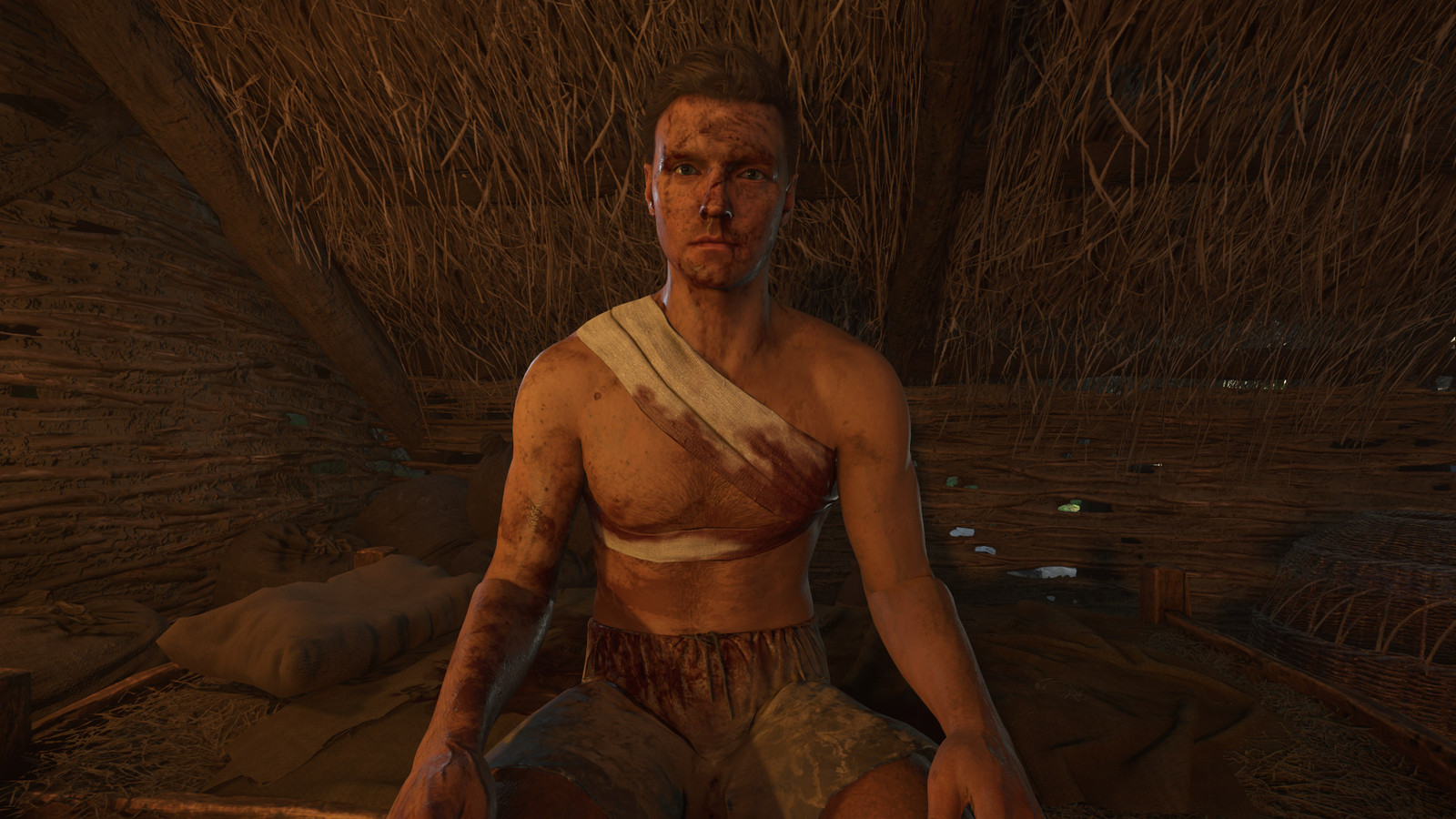 Yet Another Bandage