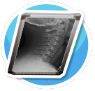 x-ray pelvis