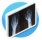 x-ray hands