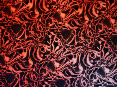 ФОРТ