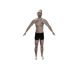 Beaten patient preview