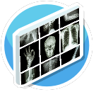 Fracture Ward - X Ray