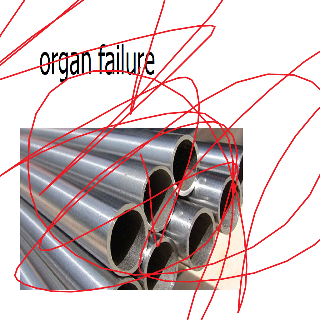 organ failure