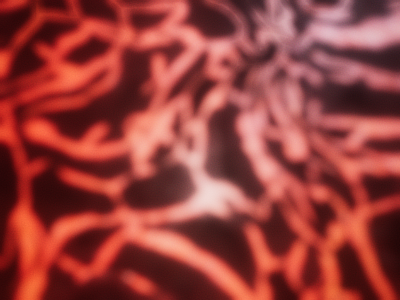 sda