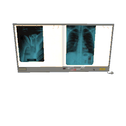 x-ray