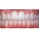 Teeth Mod – tModLoader Mod
