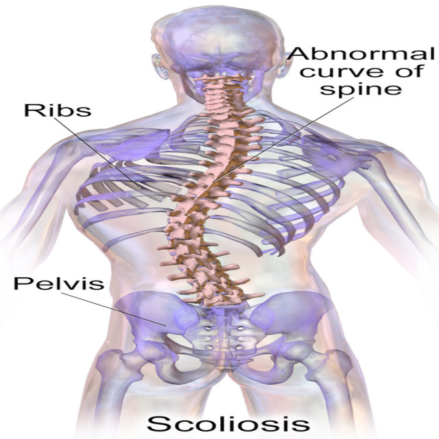 Spine