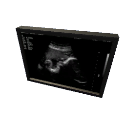 Stages of Ultrasounds