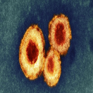 Human metapneumovirus (HMPV)
