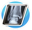 xray6