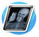 xray7