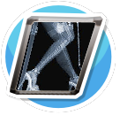 xray11
