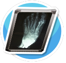 xray foot