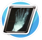 foot Xray