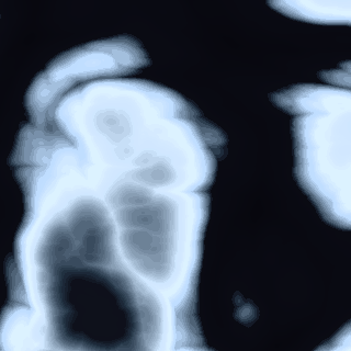 X-ray