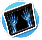 Hand Xray