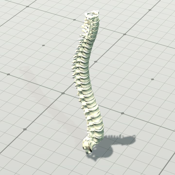 spine_